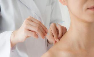 Acupuncture
